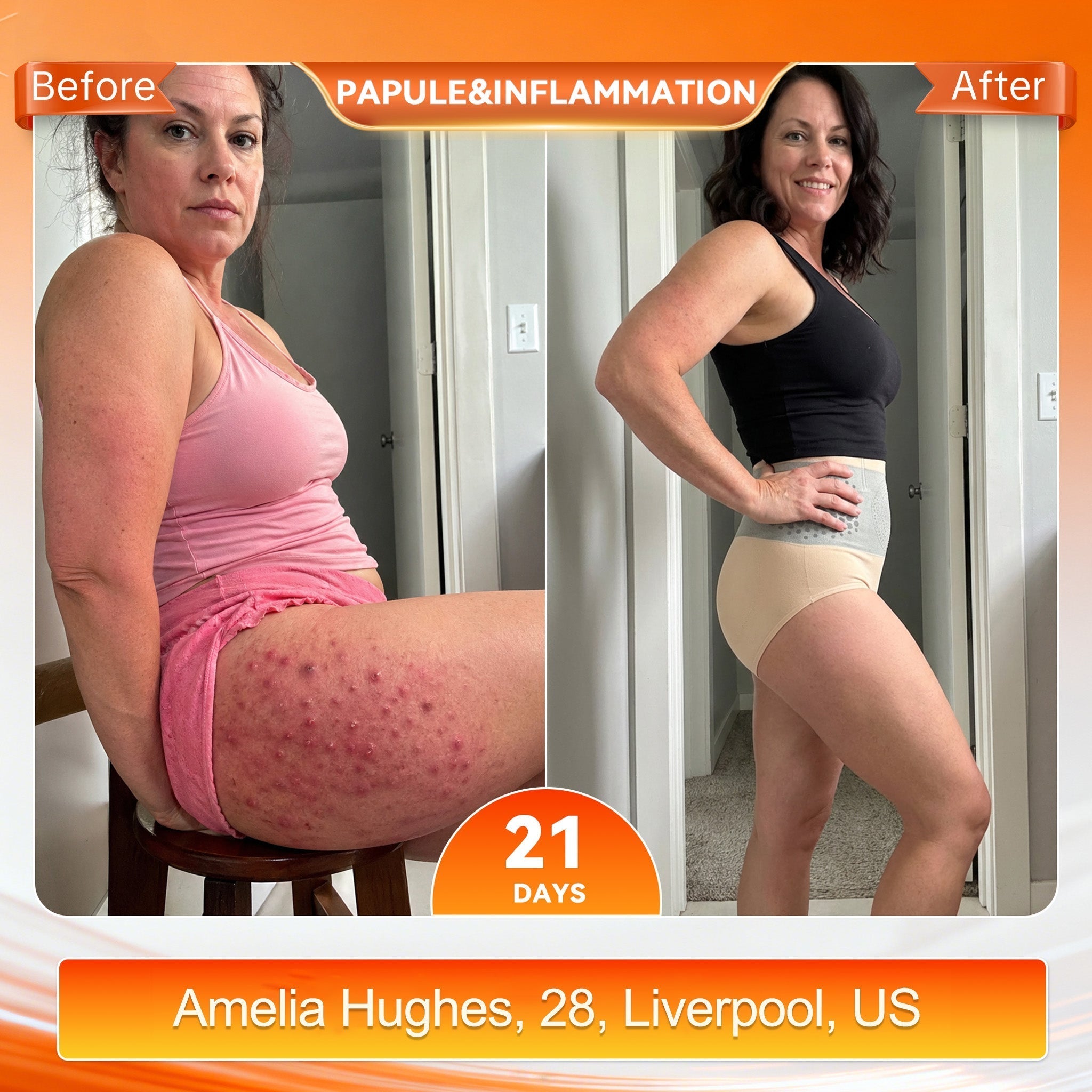 𝐌𝐨𝐫𝐢𝐧𝐠𝐚 & 𝐁𝐞𝐫𝐛𝐞𝐫𝐢𝐧𝐞 𝟒-𝐈𝐧-𝟏 𝐌𝐢𝐜𝐫𝐨-𝐏𝐚𝐫𝐭𝐢𝐜𝐥𝐞 𝐒𝐜𝐮𝐥𝐩𝐭𝐢𝐧𝐠 & 𝐅𝐚𝐭-𝐁𝐮𝐫𝐧 𝐒𝐡𝐨𝐫𝐭𝐬