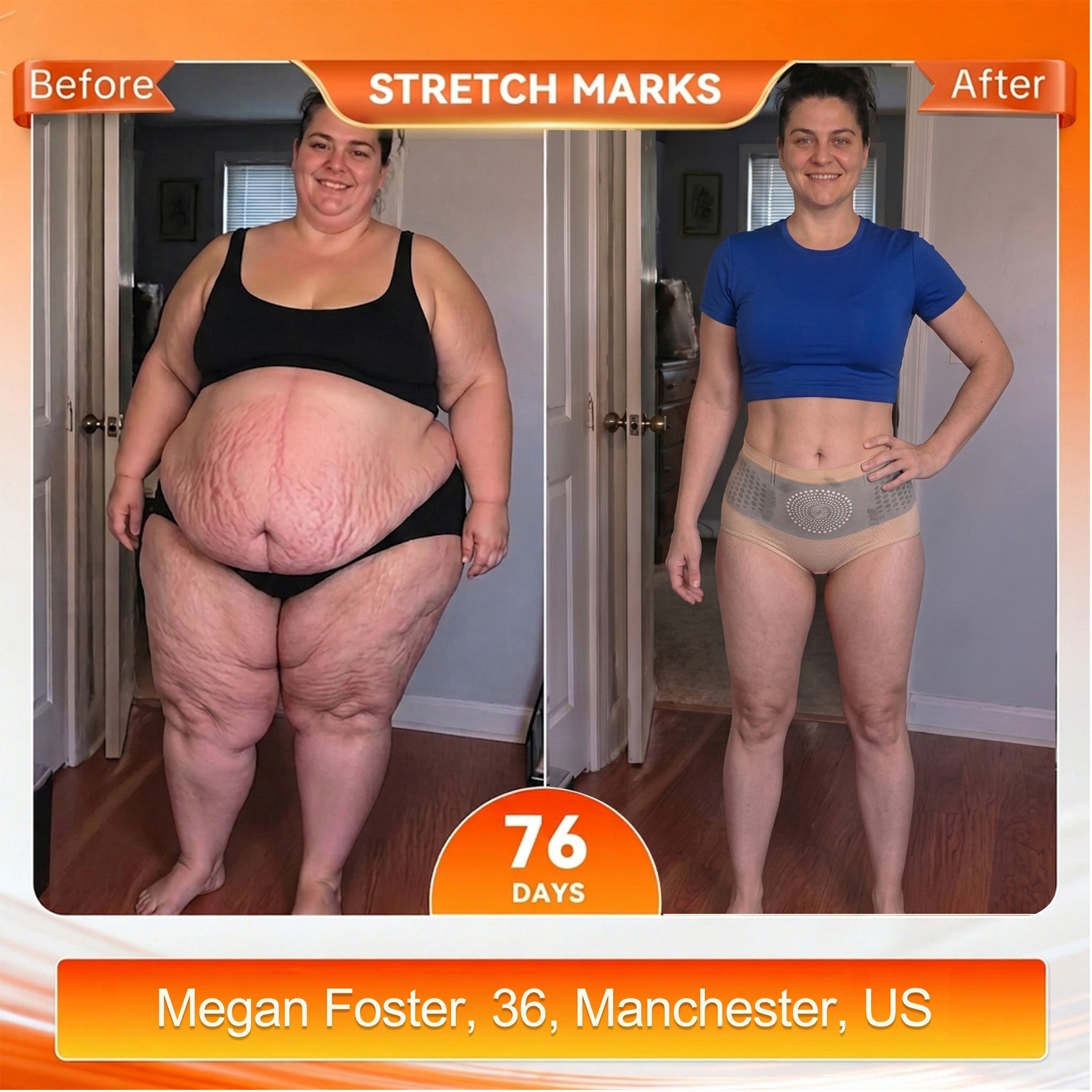 𝐌𝐨𝐫𝐢𝐧𝐠𝐚 & 𝐁𝐞𝐫𝐛𝐞𝐫𝐢𝐧𝐞 𝟒-𝐈𝐧-𝟏 𝐌𝐢𝐜𝐫𝐨-𝐏𝐚𝐫𝐭𝐢𝐜𝐥𝐞 𝐒𝐜𝐮𝐥𝐩𝐭𝐢𝐧𝐠 & 𝐅𝐚𝐭-𝐁𝐮𝐫𝐧 𝐒𝐡𝐨𝐫𝐭𝐬